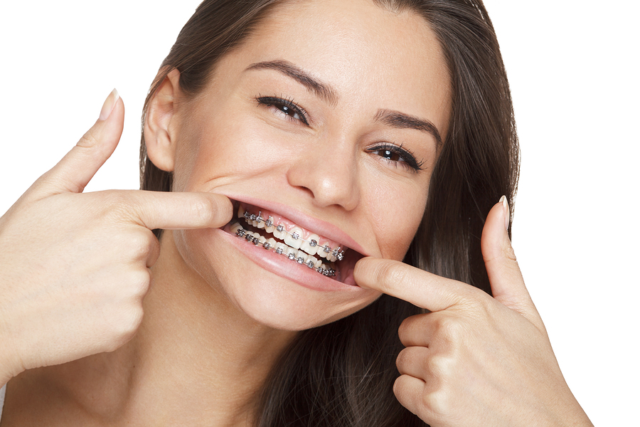 facts-about-dental-braces