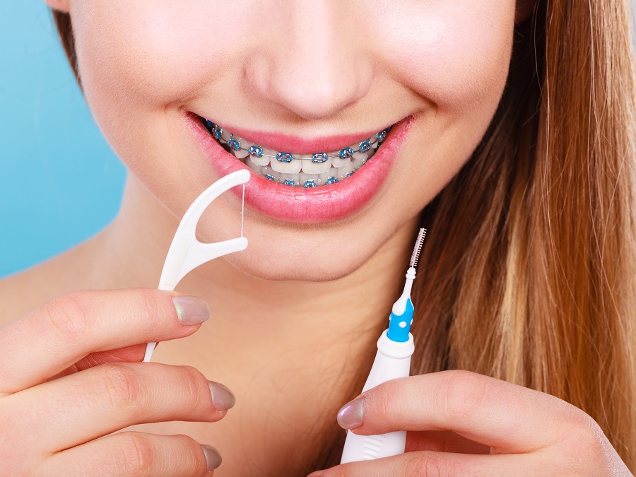 Dentist Newport Beach: Cleaning Teeth With Braces And Tight Junctions