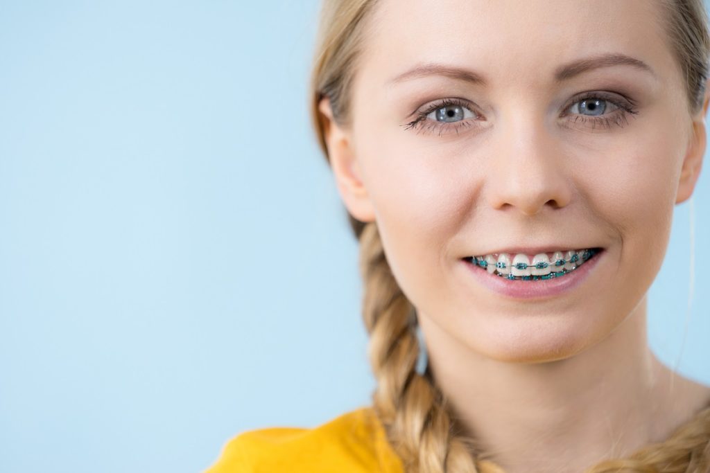 You-Be-Glad-You-Spoke-To-Your-Dentist-Newport-Beach-About-Getting-Braces