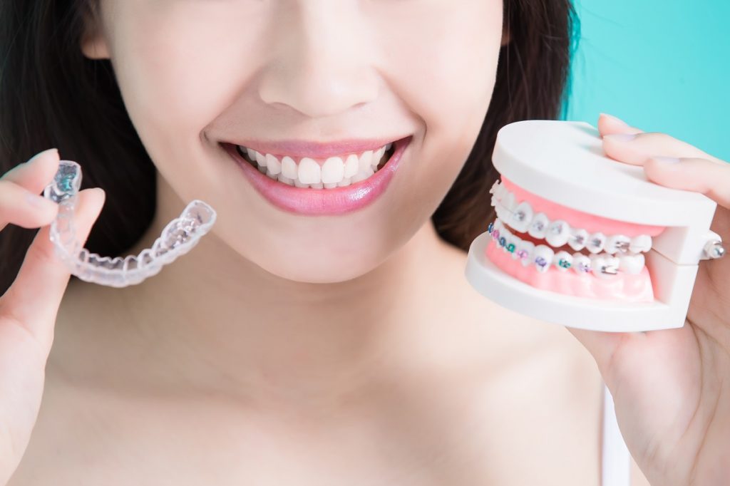 Newport-Beach-Dentist-give-you-options-for-orthodontic-treatment