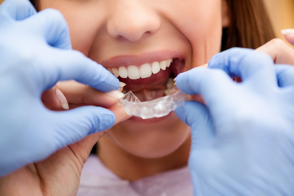 Visit-Dentist-Newport-Beach-To-Ensure-Safe-Removal-Of-Braces